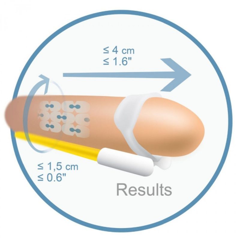 16070 ANDROEXTENDER &ndash; ANDROPENIS BASIC TRATTAMENTO PER L&rsquo;INGRANDIMENTO DEL PENE